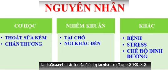 Điều trị tắc tia sữa tắc tia sữa