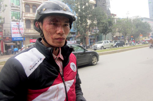 Tài xế và phụ xe bus đánh hành khách gục ngã giữa thủ đô Tài xế và phụ xe bus đánh hành khách gục ngã giữa thủ đô